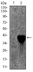 Antibody data